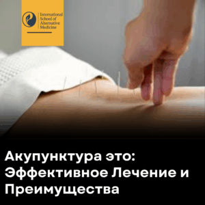 Акупунктура это