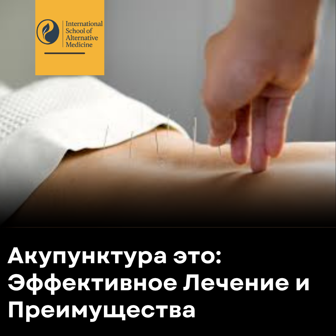Акупунктура это