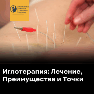 Иглотерапия